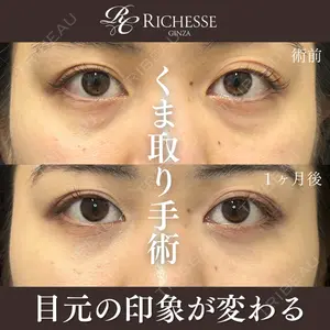 症例