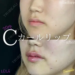 ルラ美容クリニック 新宿院 古市 まり江医師の症例