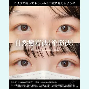 シンデレラ＆ダヴィンチクリニック 宮田 洋佑医師の症例