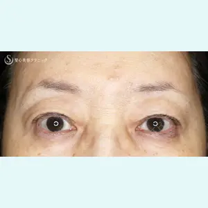 聖心美容クリニック 札幌院 前多 一彦医師の症例