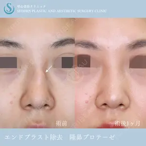 聖心美容クリニック 六本木院 川端 優也医師の症例