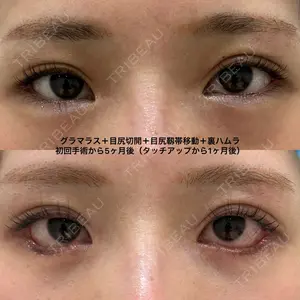エターナル美容クリニック 久門田 詳医師の症例