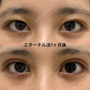 エターナル美容クリニック 久門田 詳医師の症例