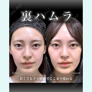 症例