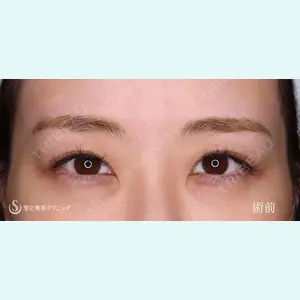 聖心美容クリニック 六本木院 川端 優也医師の症例