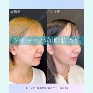 ルラ美容クリニック 札幌院 佐藤 雄紀医師の症例