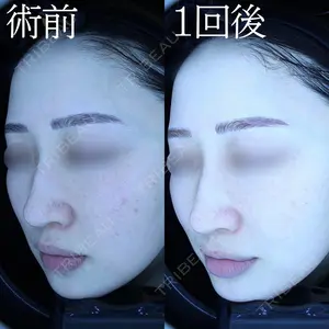 HAAB BEAUTY CLINIC 名古屋院の症例