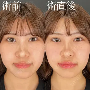 HAAB×DREAM BEAUTY CLINIC 大阪梅田院 柏木 太雅医師の症例