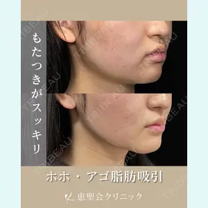 症例
