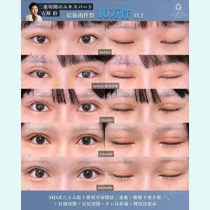 症例