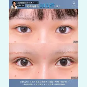 症例