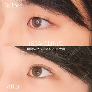 症例