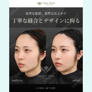 症例