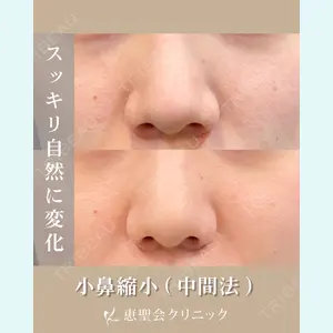 症例