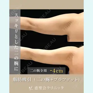 症例