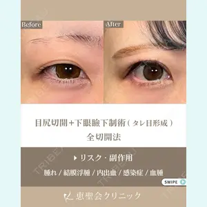 恵聖会クリニック 京橋院 田川 大地医師の症例