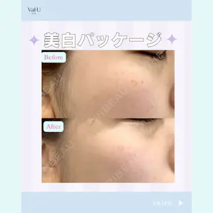 Valu （バリュー） クリニック イ・スンヒョン医師の症例