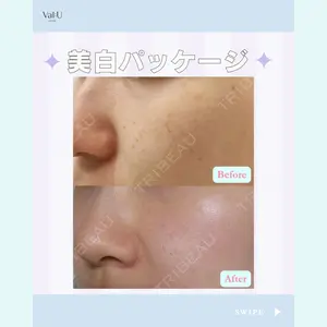 Valu （バリュー） クリニック イ・スンヒョン医師の症例