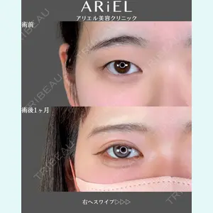 アリエル美容クリニック 郡山院 安齋 誠基医師の症例
