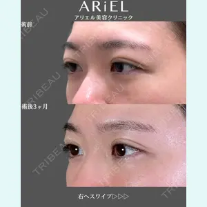 アリエル美容クリニック 郡山院 安齋 誠基医師の症例