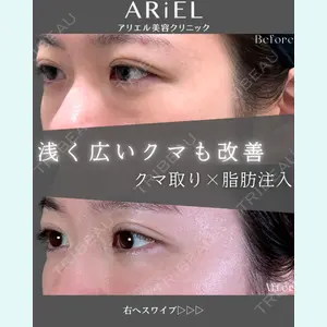 アリエル美容クリニック 郡山院 安齋 誠基医師の症例