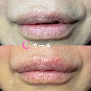 症例