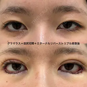 エターナル美容クリニックの症例