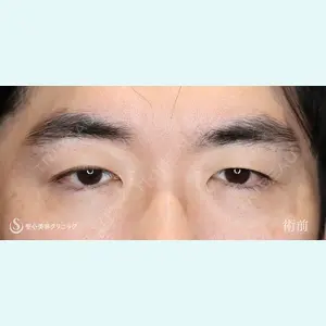 聖心美容クリニック 六本木院 川端 優也医師の症例