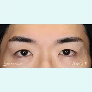聖心美容クリニック 六本木院 川端 優也医師の症例