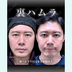 症例