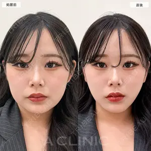 A CLINIC（エークリニック） 横浜院 柴田 貴志医師の症例