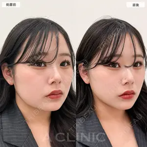 A CLINIC（エークリニック） 横浜院 柴田 貴志医師の症例