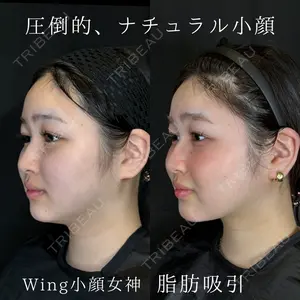 症例
