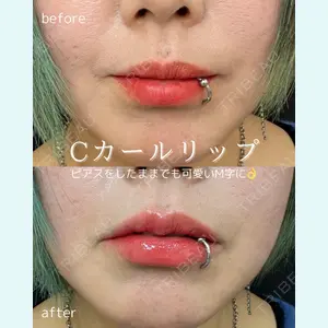 ルラ美容クリニック 仙台院 橋本 英樹医師の症例