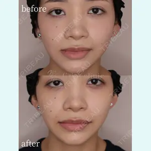 Grias clinic （ジリアスクリニック）の症例