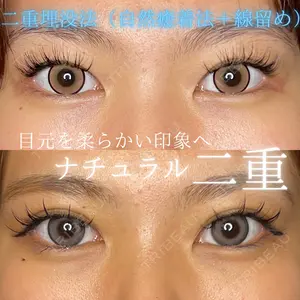 症例