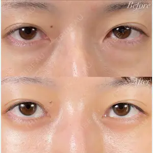 症例