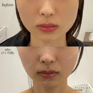 DMTC美容皮膚科 日本橋院 山中大介医師の症例