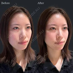 HAAB×DREAM BEAUTY CLINIC 東京本院 佐野 圭医師の症例