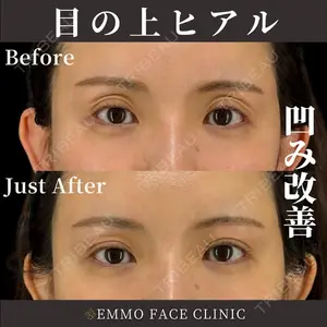 EMMO FACE CLINIC 東京三田院 木之下 哲彦医師の症例