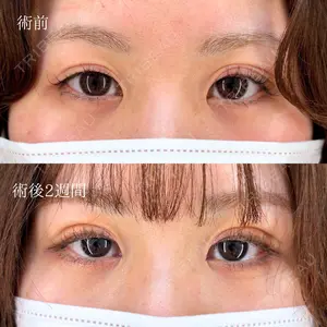 HAAB×DREAM BEAUTY CLINIC 東京本院 萩原 昂医師の症例
