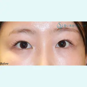 聖心美容クリニック 六本木院 星野 善允医師の症例