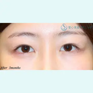 聖心美容クリニック 六本木院 星野 善允医師の症例