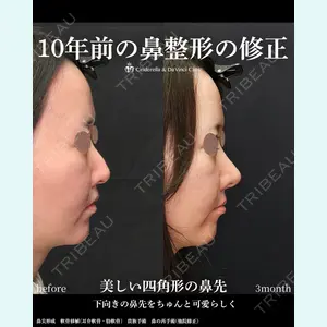 シンデレラ＆ダヴィンチクリニック 宮田 洋佑医師の症例