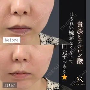 症例