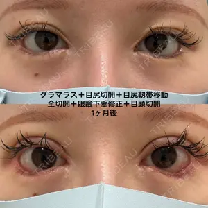 エターナル美容クリニック 久門田 詳医師の症例