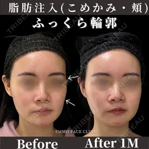 EMMO FACE CLINIC 東京三田院 木之下 哲彦医師の症例