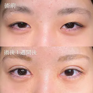 症例