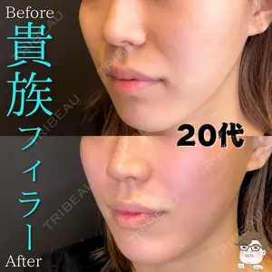ルラ美容クリニック 札幌院 佐藤 雄紀医師の症例