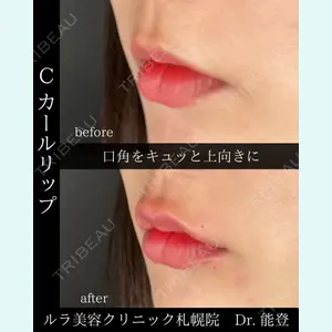 ルラ美容クリニック 札幌院 能登 貴弘医師の症例